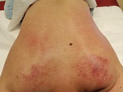 -阮氏中医推拿·颈肩腰腿(世纪公园店)