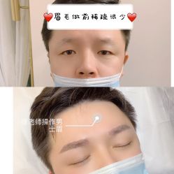 点击看大图 -变美丽半永久纹眉连锁·机器野生眉•洗眉