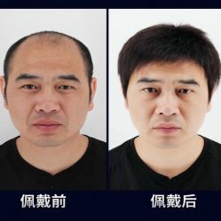 -发饰美男士增发补发假发定制店