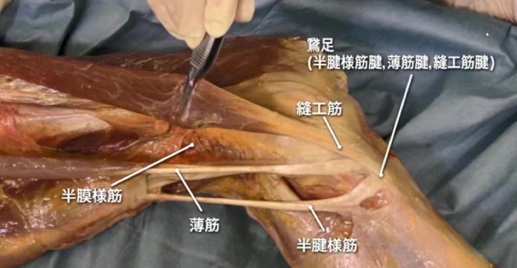 膝关节鹅掌腱位置图片图片