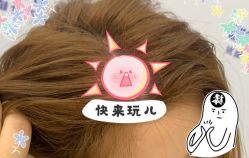 -大麦微针植发全国连锁