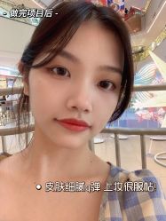 体验后-慕颜医疗美容·皮肤微整 抗衰
