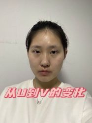 -美莱医学美容医院