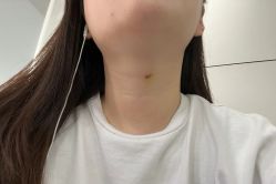 -美安心医美·美迪迈黄金微针·美拉美医疗美容