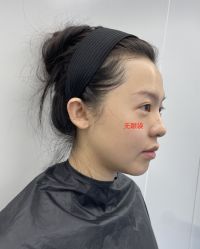 -天津健丽·去眼袋医疗美容机构