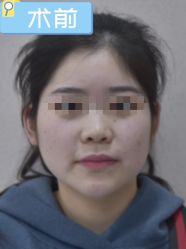 -素美医疗美容·西南眼鼻整形·修复基地