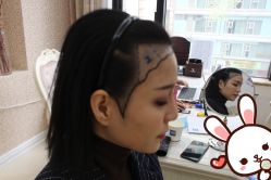 -大麦微针植发丨全国连锁