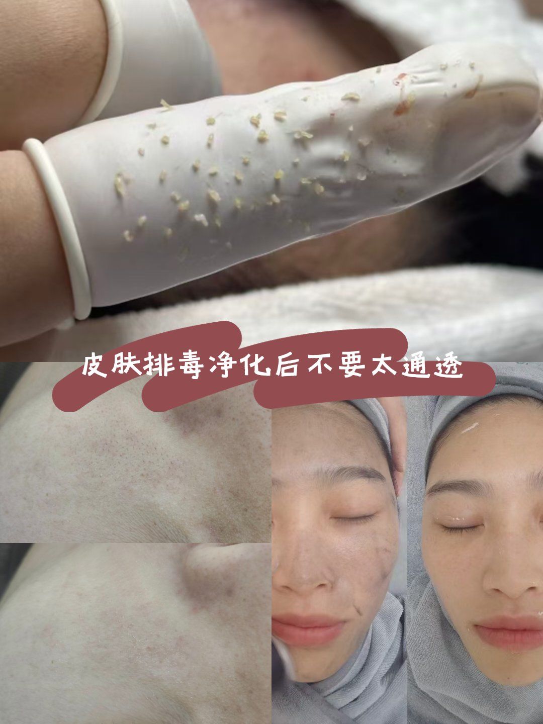 面部排毒后效果真的不要太透亮