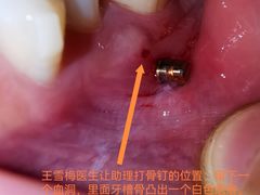 -极光口腔·矫正种植修复(锦江店)
