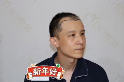 点击看大图 -熙朵美学植发连锁