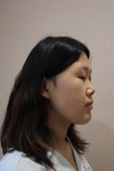 -北京米扬丽格医疗美容·联合丽格鼻整形中心