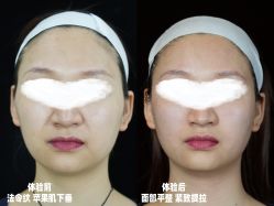 -Yestar重庆艺星医疗美容医院