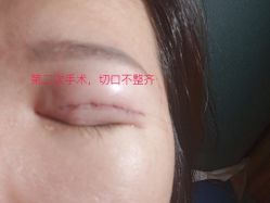 -深圳阳光医疗美容医院·旗舰店