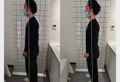 -菊子小颜·日式整骨