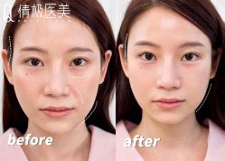 -倩极·精研痘敏肌管理
