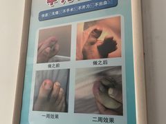 -世龙世家灰指甲鸡眼脚气甲沟炎跖疣护理(通州店)