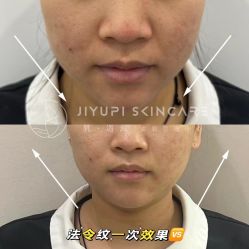 -MLP美丽派·问题肌疗愈中心