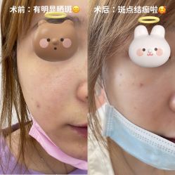 -针美汇欧邦医疗美容