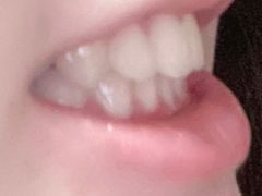 -深圳佑诺口腔门诊部