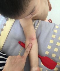 -小米熊儿童医院