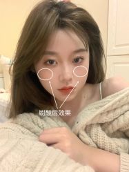 -长沙雅美医疗美容医院