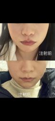 体验后-恒博天姿医疗美容