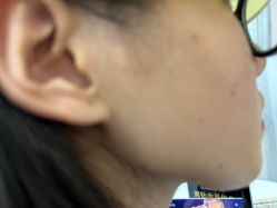 -广州美莱医疗美容医院