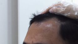 -雍禾植发全国连锁