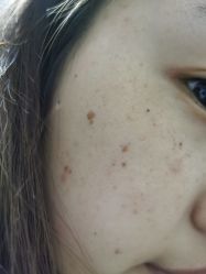 -坤如玛丽·医疗美容中心