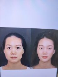 -郡艺医疗美容·微整·眼鼻吸脂