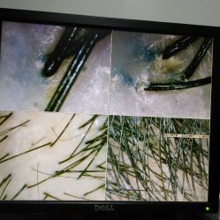 -章光101防脱养发荟