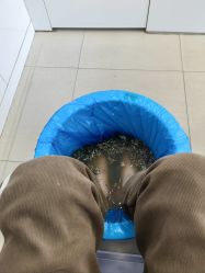 -德哥灰指甲脚气甲沟炎跖疣护理