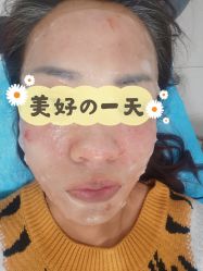 -天津健丽·去眼袋医疗美容机构