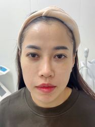 -Yestar杭州艺星医疗美容医院