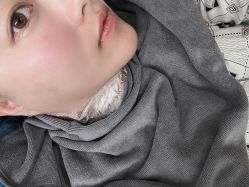 -天津健丽·去眼袋医疗美容机构