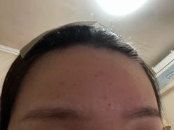 -苗方清颜祛痘·皮肤管理