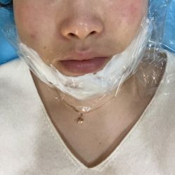 体验前-南京康美美容医院·旗舰店
