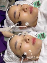 -慕颜医疗美容·皮肤微整 抗衰