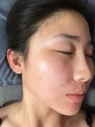 -美安心医美·美迪迈黄金微针·美拉美医疗美容