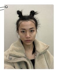 -大麦微针植发全国连锁
