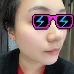 体验后-禾丽康美医疗美容医院
