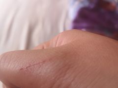 -上海市普陀区中心医院