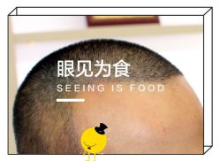 -大麦微针植发全国连锁