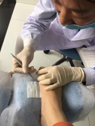 点击看大图 -派恩宜灰指甲·甲沟炎·鸡眼康护