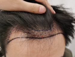 -熙朵美学植发·连锁品牌