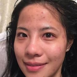 -苗方清颜痘肌研究所