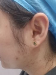 -美瑞莎创美医疗美容