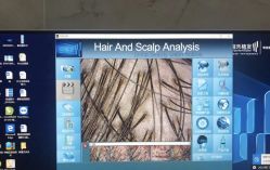 -雍禾植发全国连锁