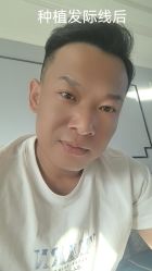 -大麦微针植发丨全国连锁