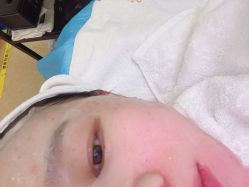 体验后-禾丽康美医疗美容医院